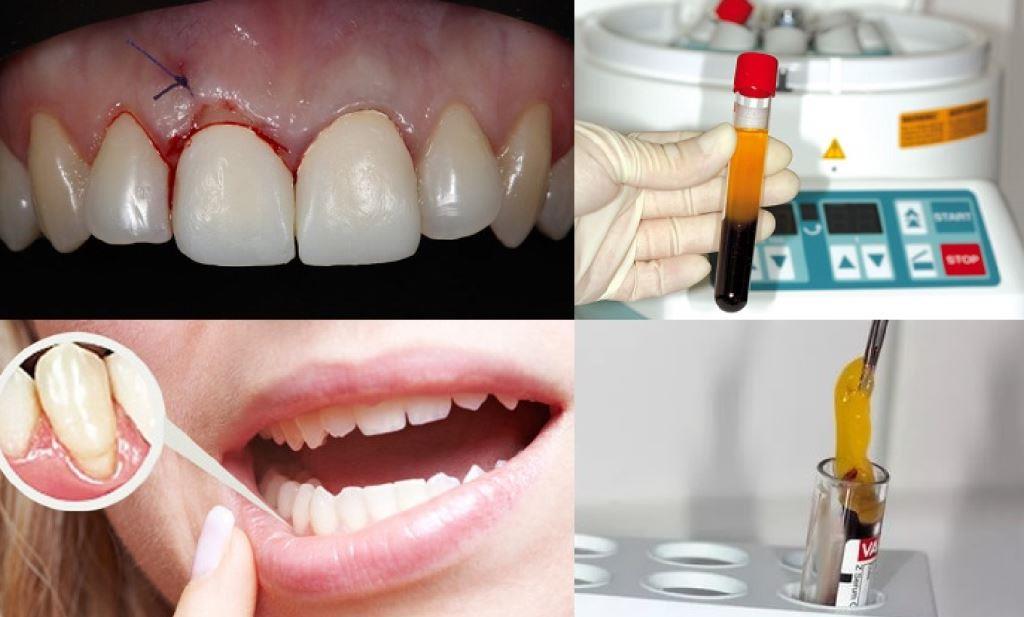 центрифуга медицинская лабораторная armed, центрифуга настольная медицинская, центрифуга стоматологическая, центрифуги лабораторные настольные, центрифуги лабораторные роторы, цена, купить, в Алматы, Нур-Султане, Астане, Шымкенте, Усть-Каменногорске, Караганде, Атырау, Актобе, Актау, Костанае центрифуга медицинская лабораторная armed, центрифуга настольная медицинская, центрифуга стоматологическая, центрифуги лабораторные настольные, центрифуги лабораторные роторы, цена, купить, в Алматы, Нур-Султане, Астане, Шымкенте, Усть-Каменногорске, Караганде, Атырау, Актобе, Актау, Костанае