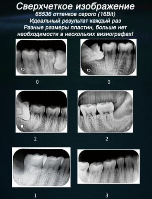 VistaScan Mini View, Durr Dental, Trident, KaVo Scan eXam One, Satelec Acteon Group,Беспроводной визиограф, сканер фосфорных пластин, визиограф купить в Алматы, VRN EQ 600 купить в Казахстане, визиограф для стоматологии