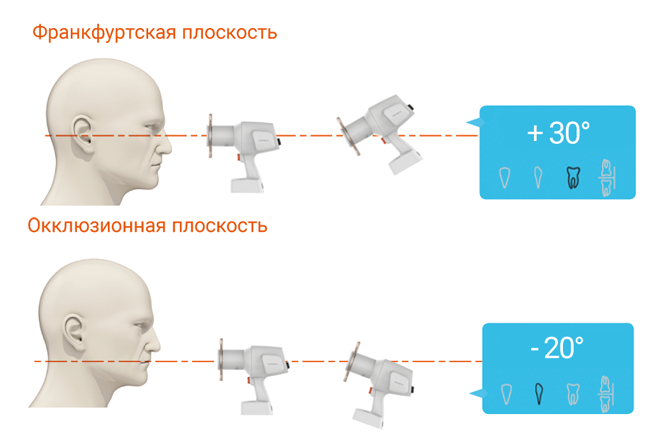 vatech vatech ezray air vatech ezray air portable vatech ezsensor купить Алматы