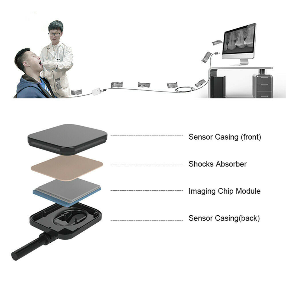 визиограф стоматологический купить, датчик для визиографа, дентальный рентген, купить визиограф, купить радиовизиограф, радиовизиограф стоматологический, радиовизиограф цена, снимок на визиографе, стоматология радиовизиограф, стоматология рентген, визиограф стоматологический купить, датчик для визиографа, дентальный рентген, купить визиограф, купить радиовизиограф, радиовизиограф стоматологический, радиовизиограф цена, снимок на визиографе, стоматология радиовизиограф, стоматология рентген,
