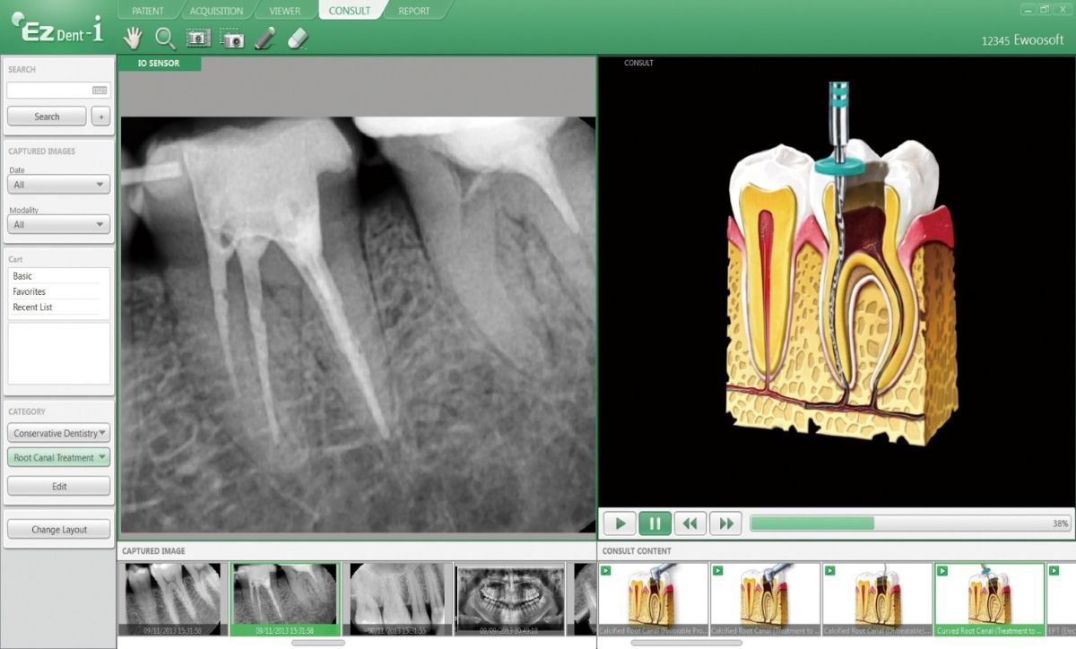 датчик для визиографа. дентальный рентген Астана